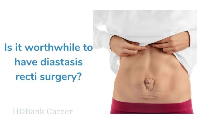 Is it worthwhile to have diastasis recti surgery?